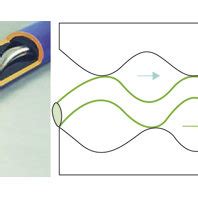 case study about screw pump breakdown|Analysis of Leakage Model of All.